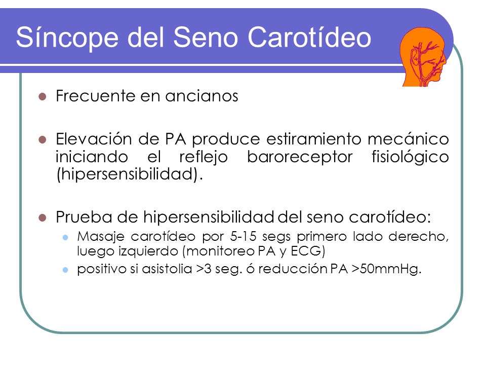 hipersensibilidad del seno carotideo